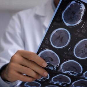 A doctor holding and examining a sheet of brain scan images, such as MRI or CT scans.
