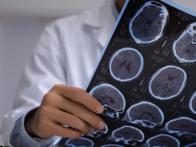 A doctor holding and examining a sheet of brain scan images, such as MRI or CT scans.